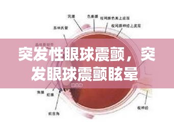 突发性眼球震颤，突发眼球震颤眩晕 